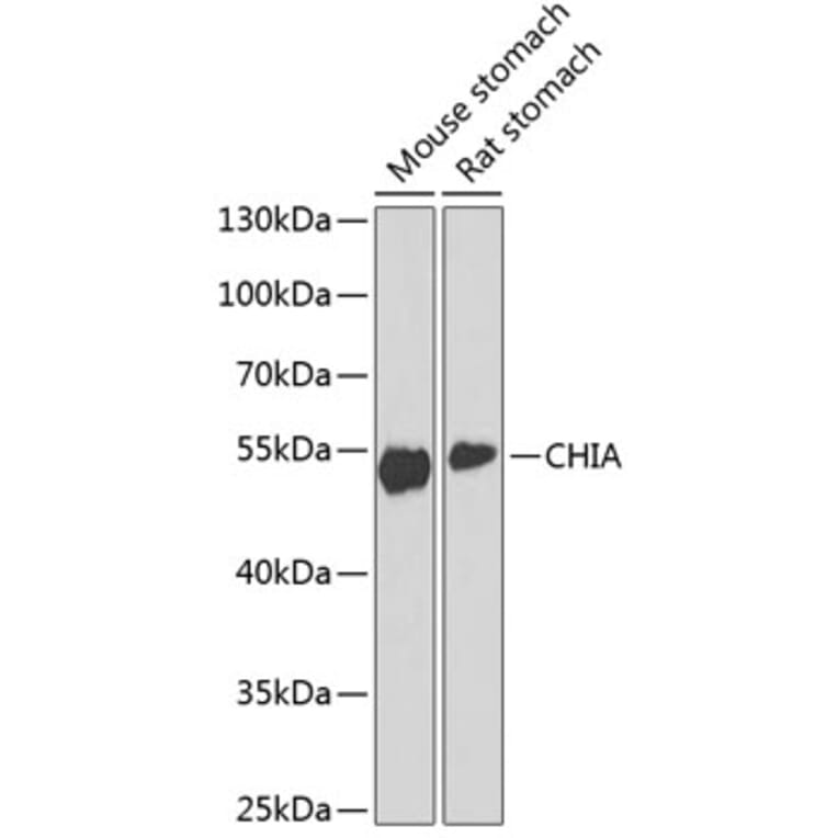 Western Blot - Anti-AMCase Antibody (A90351) - Antibodies.com