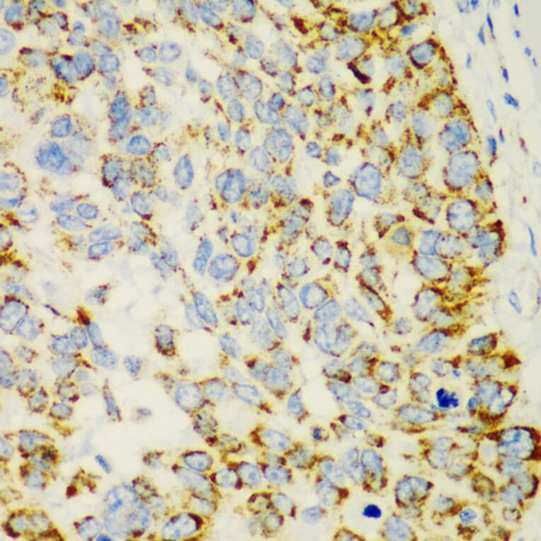 Immunohistochemistry - Anti-AMCase Antibody (A90351) - Antibodies.com