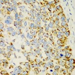 Immunohistochemistry - Anti-AMCase Antibody (A90351) - Antibodies.com