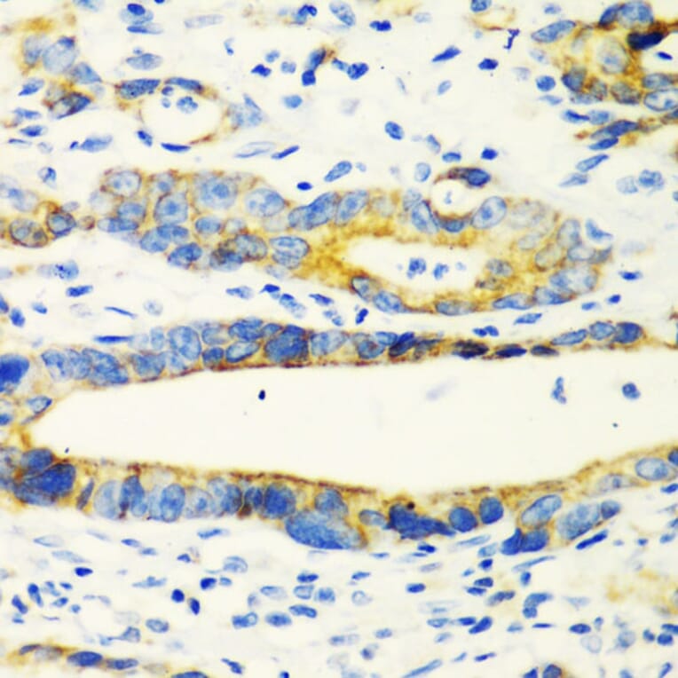 Immunohistochemistry - Anti-AMCase Antibody (A90351) - Antibodies.com