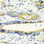 Immunohistochemistry - Anti-AMCase Antibody (A90351) - Antibodies.com
