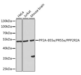 Western Blot - Anti-PPP2R2A Antibody (A90352) - Antibodies.com