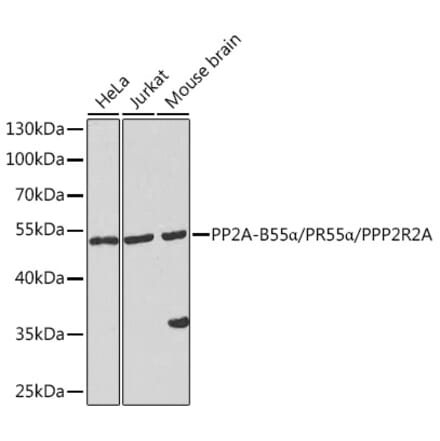 Western Blot - Anti-PPP2R2A Antibody (A90352) - Antibodies.com