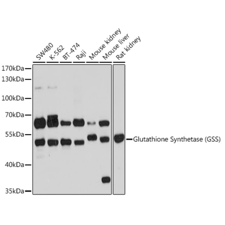 Western Blot - Anti-Glutathione Synthetase Antibody (A90353) - Antibodies.com