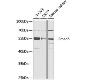 Western Blot - Anti-SMAD5 Antibody (A90354) - Antibodies.com