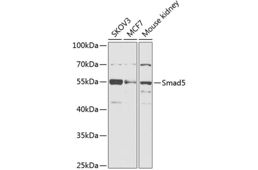 Western Blot - Anti-SMAD5 Antibody (A90354) - Antibodies.com