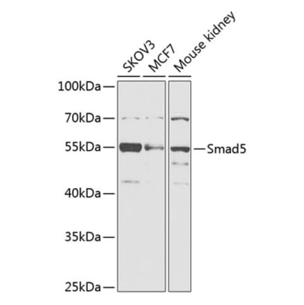 Western Blot - Anti-SMAD5 Antibody (A90354) - Antibodies.com