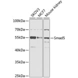 Western Blot - Anti-SMAD5 Antibody (A90354) - Antibodies.com