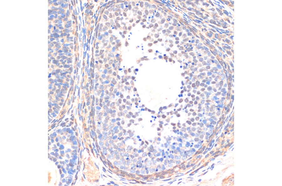 Immunohistochemistry - Anti-SMAD5 Antibody (A90354) - Antibodies.com