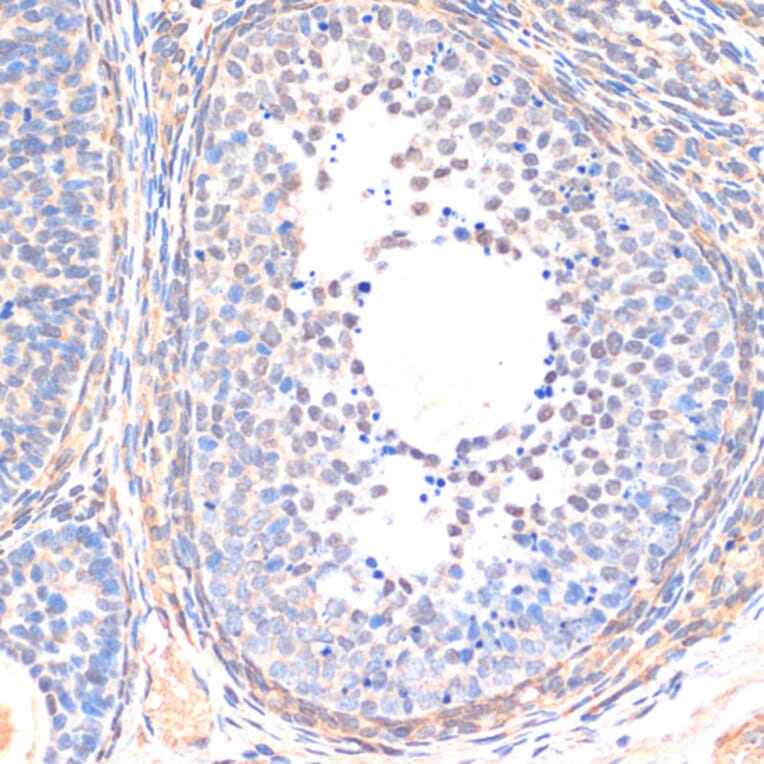 Immunohistochemistry - Anti-SMAD5 Antibody (A90354) - Antibodies.com