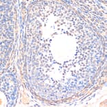 Immunohistochemistry - Anti-SMAD5 Antibody (A90354) - Antibodies.com