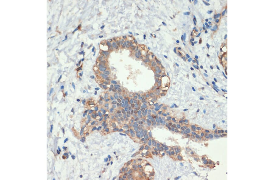 Immunohistochemistry - Anti-SMAD5 Antibody (A90354) - Antibodies.com