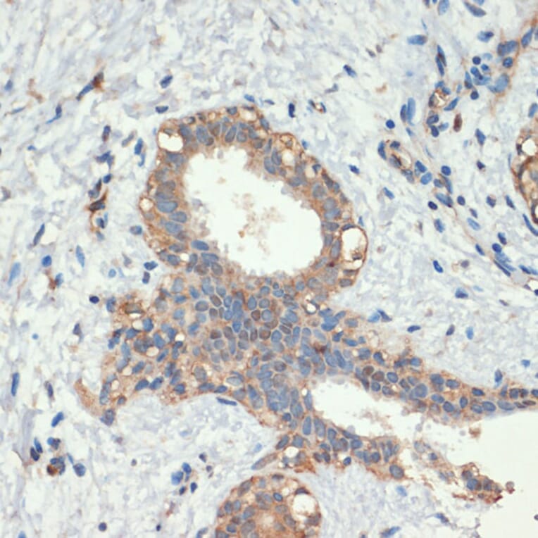 Immunohistochemistry - Anti-SMAD5 Antibody (A90354) - Antibodies.com