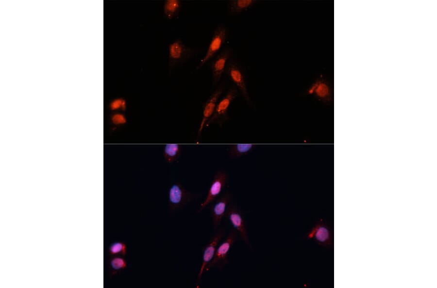 Immunofluorescence - Anti-SMAD5 Antibody (A90354) - Antibodies.com