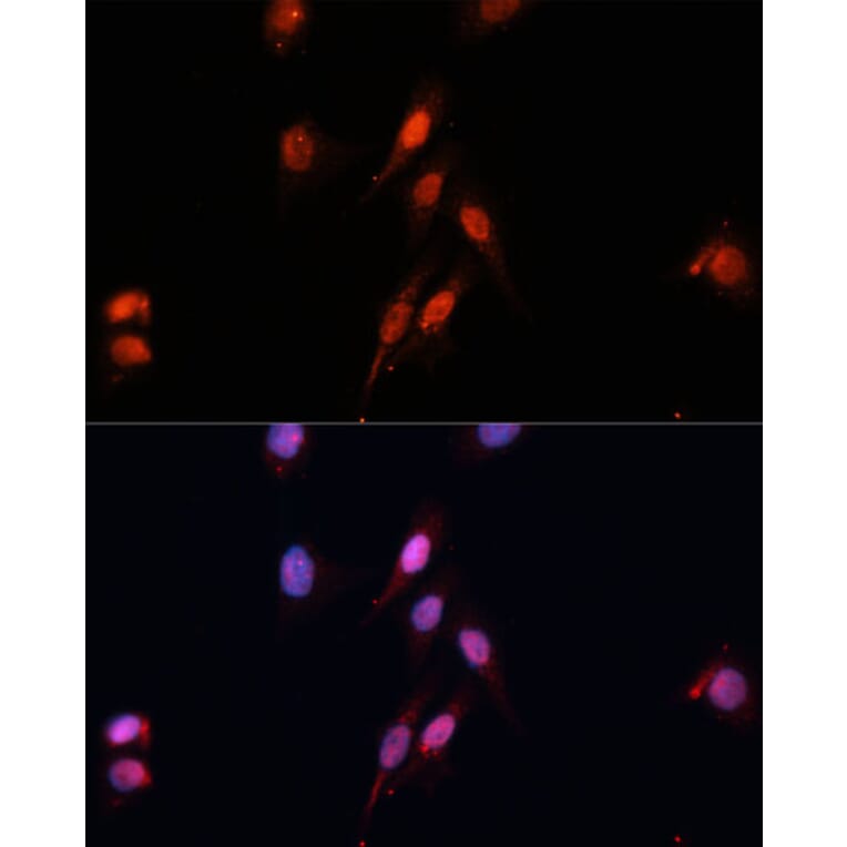 Immunofluorescence - Anti-SMAD5 Antibody (A90354) - Antibodies.com