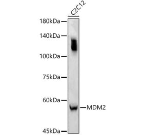 Western Blot - Anti-MDM2 Antibody (A90355) - Antibodies.com
