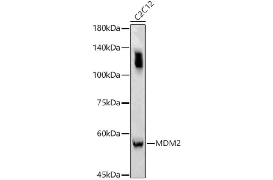 Western Blot - Anti-MDM2 Antibody (A90355) - Antibodies.com