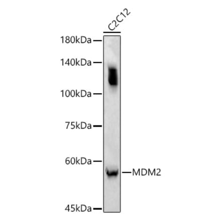 Western Blot - Anti-MDM2 Antibody (A90355) - Antibodies.com