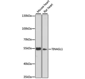 Western Blot - Anti-TINAGL1 Antibody (A90356) - Antibodies.com