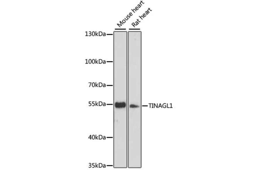 Western Blot - Anti-TINAGL1 Antibody (A90356) - Antibodies.com