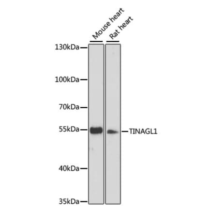 Western Blot - Anti-TINAGL1 Antibody (A90356) - Antibodies.com