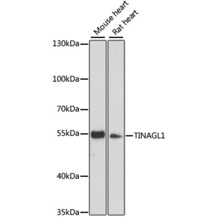 Western Blot - Anti-TINAGL1 Antibody (A90356) - Antibodies.com