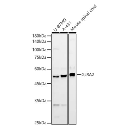 Western Blot - Anti-GLRA2 Antibody (A90357) - Antibodies.com