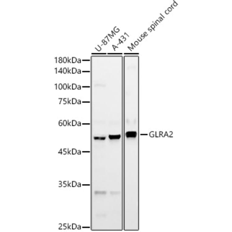 Western Blot - Anti-GLRA2 Antibody (A90357) - Antibodies.com