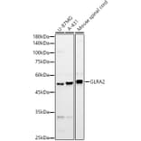 Western Blot - Anti-GLRA2 Antibody (A90357) - Antibodies.com