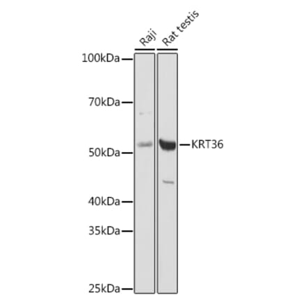 Western Blot - Anti-Keratin 36 Antibody (A90358) - Antibodies.com