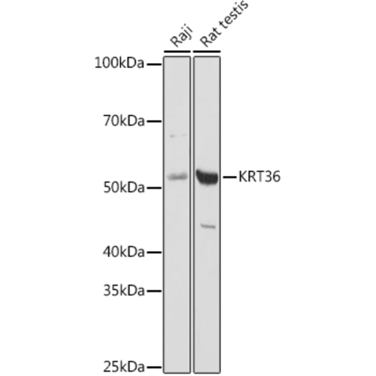 Western Blot - Anti-Keratin 36 Antibody (A90358) - Antibodies.com