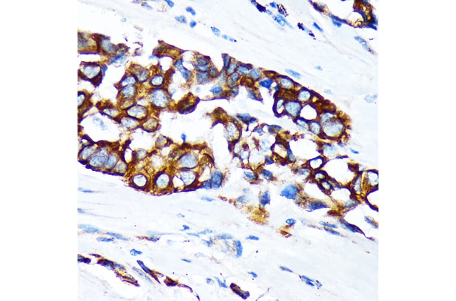 Immunohistochemistry - Anti-Keratin 36 Antibody (A90358) - Antibodies.com