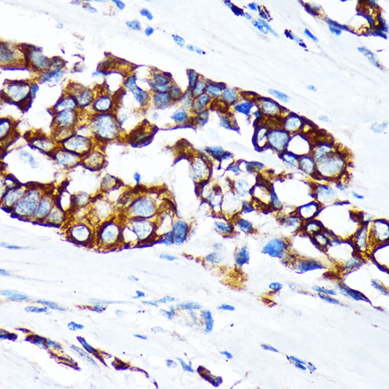 Immunohistochemistry - Anti-Keratin 36 Antibody (A90358) - Antibodies.com