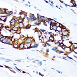 Immunohistochemistry - Anti-Keratin 36 Antibody (A90358) - Antibodies.com