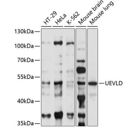 Western Blot - Anti-UEVLD Antibody (A90359) - Antibodies.com