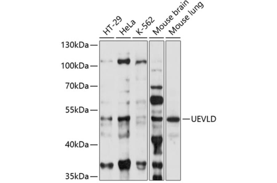 Western Blot - Anti-UEVLD Antibody (A90359) - Antibodies.com