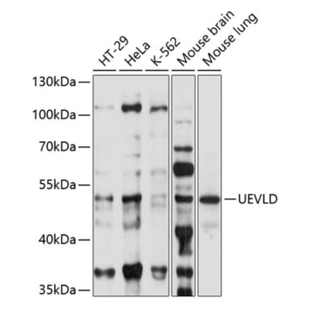 Western Blot - Anti-UEVLD Antibody (A90359) - Antibodies.com
