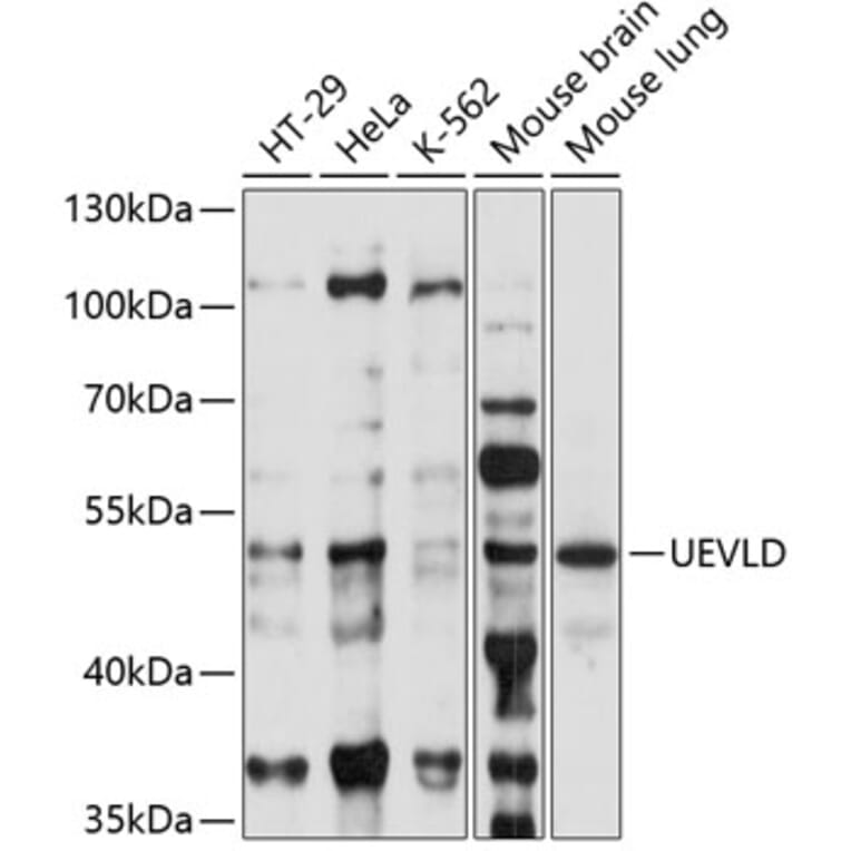 Western Blot - Anti-UEVLD Antibody (A90359) - Antibodies.com