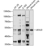 Western Blot - Anti-UEVLD Antibody (A90359) - Antibodies.com