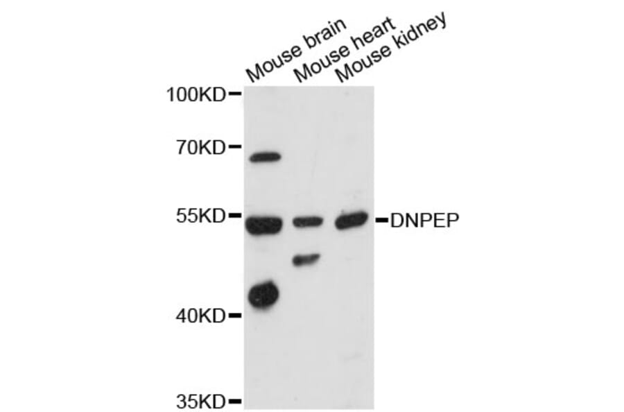Western Blot - Anti-DNPEP Antibody (A9064) - Antibodies.com