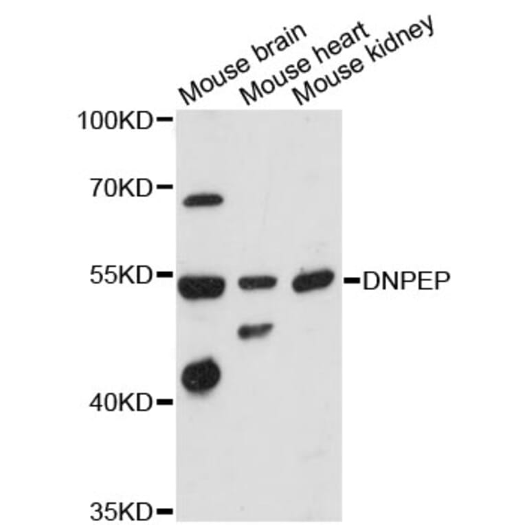 Western Blot - Anti-DNPEP Antibody (A9064) - Antibodies.com