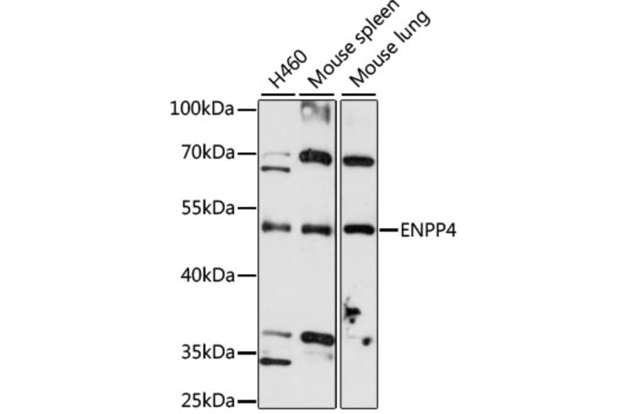 Western Blot - Anti-ENPP4 Antibody (A4516) - Antibodies.com