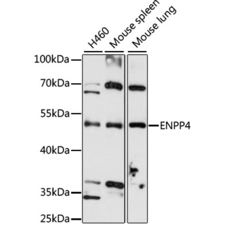 Western Blot - Anti-ENPP4 Antibody (A4516) - Antibodies.com