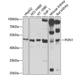 Western Blot - Anti-PON1 Antibody (A90362) - Antibodies.com