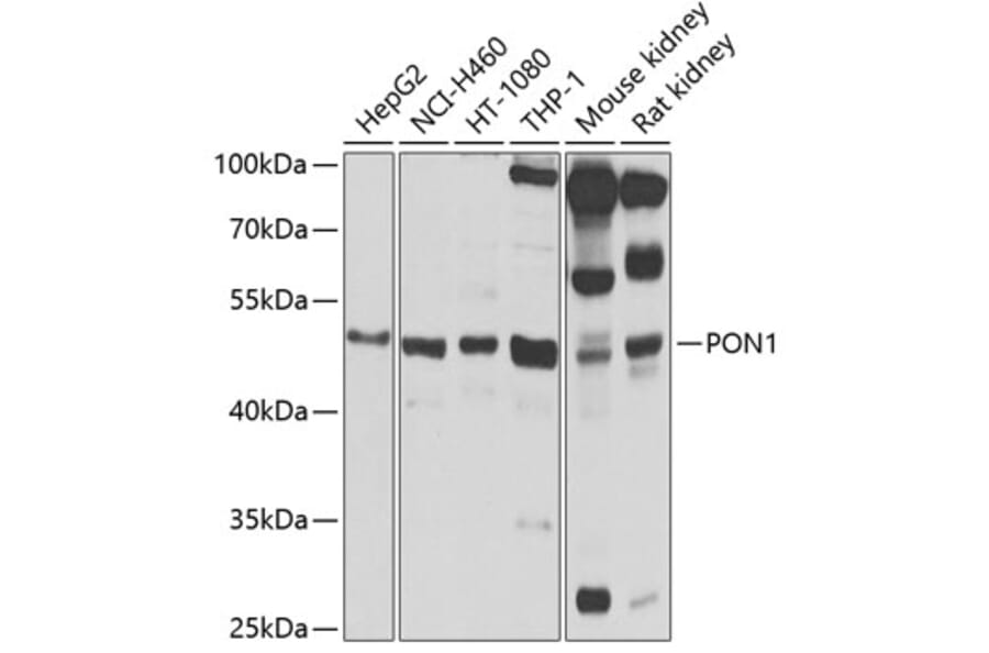 Western Blot - Anti-PON1 Antibody (A90362) - Antibodies.com