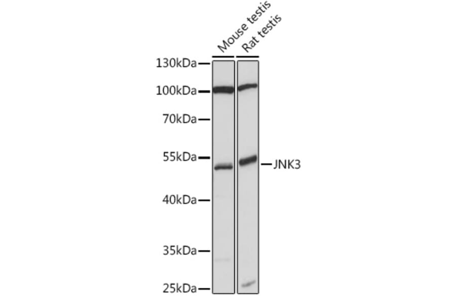 Western Blot - Anti-JNK3 Antibody (A90363) - Antibodies.com