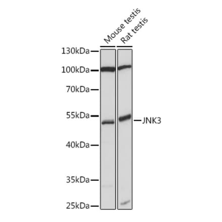 Western Blot - Anti-JNK3 Antibody (A90363) - Antibodies.com