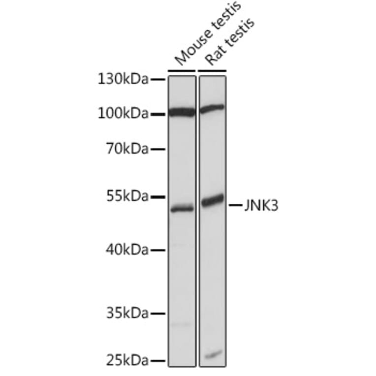 Western Blot - Anti-JNK3 Antibody (A90363) - Antibodies.com