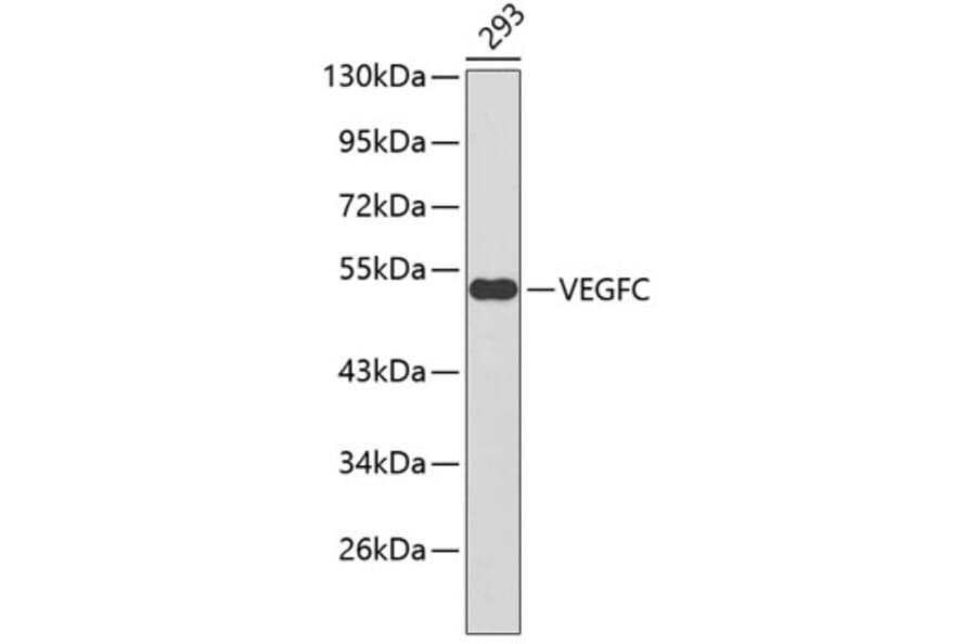 Western Blot - Anti-VEGFC Antibody (A0401) - Antibodies.com