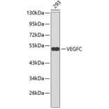 Western Blot - Anti-VEGFC Antibody (A0401) - Antibodies.com